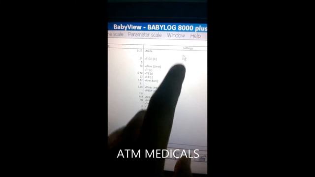Drager Babylog 8000 plus смотреть онлайн