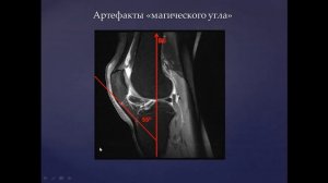 Базовый курс по МРТ  1  Лекция «Общая семиотика в МР артрологии»  Лектор  Учеваткин А А  2