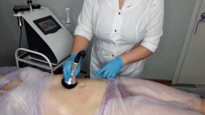 вакуумный массаж (обзор вакуумного массажа на аппарате KIM 8)