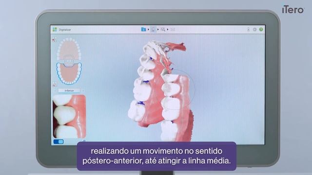 iTero™ - Ferramenta #2: Técnica Básica de Escaneamento смотреть онлайн