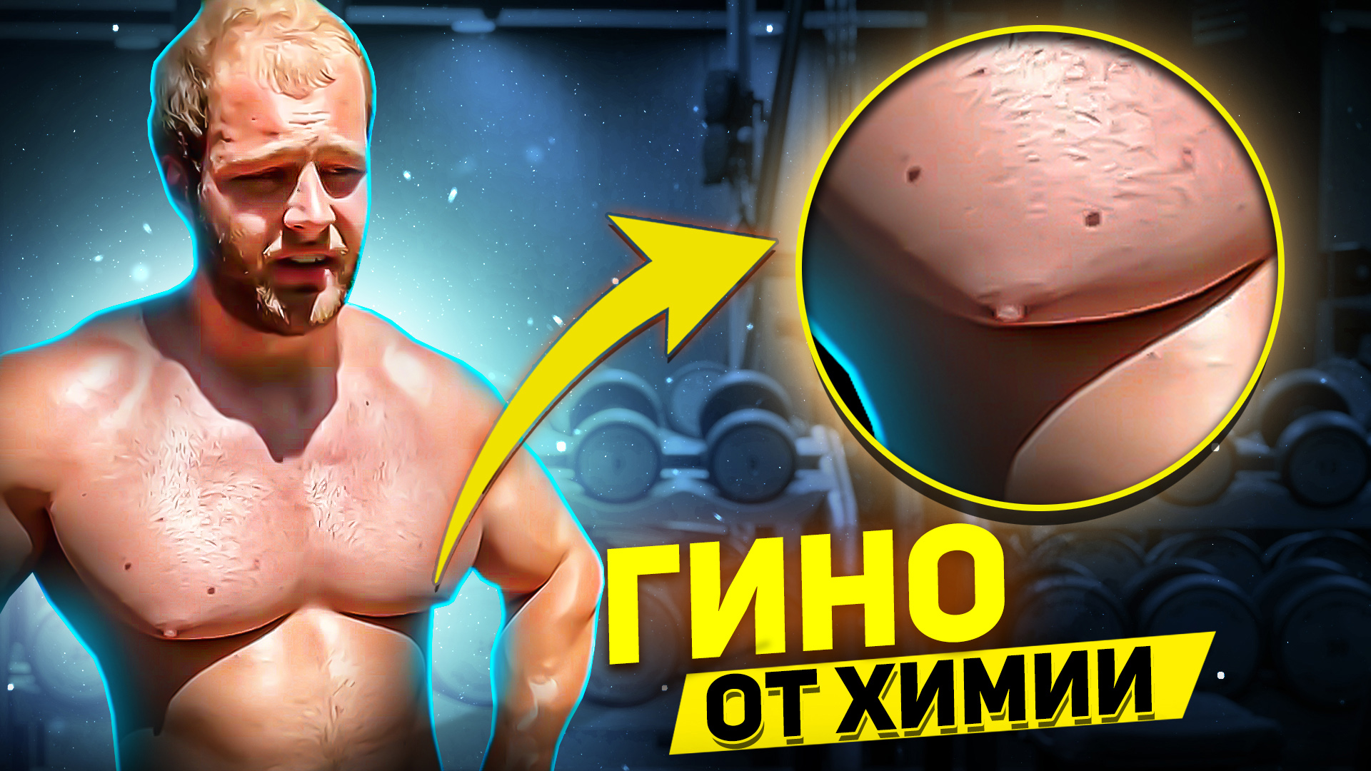 ПОЙМАНЫ НА ЛЖИ: ГИНО И АКНЕ ОТ ХИМИИ смотреть онлайн