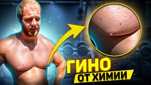 ПОЙМАНЫ НА ЛЖИ: ГИНО И АКНЕ ОТ ХИМИИ