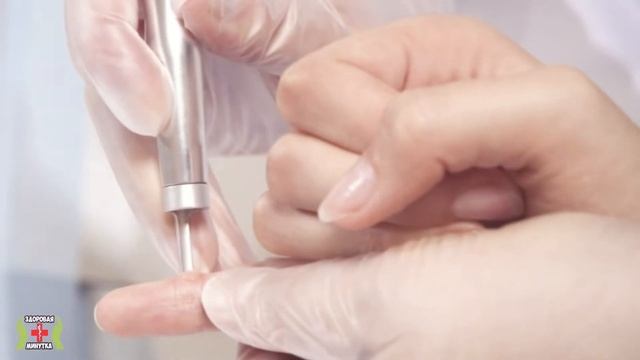 95% Людей ЭТОГО Не Знают! Как Удалить Родинки, Пигментные Пятна и Бородавки