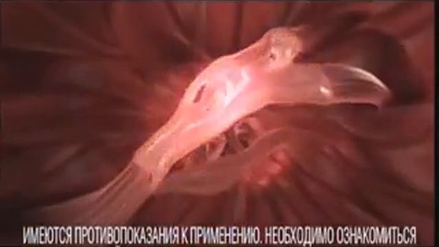 Реклама Нурофен: Нурофен гель смотреть онлайн