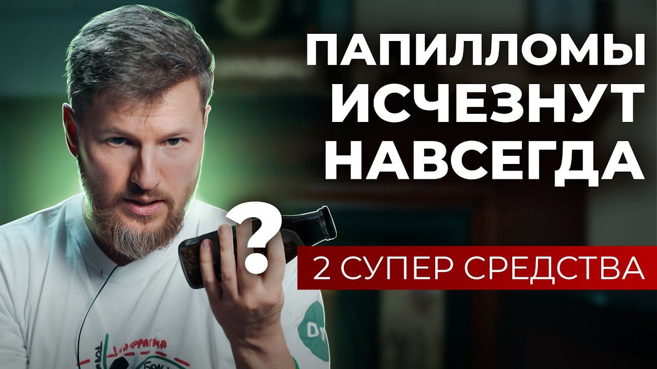 Как избавиться от папиллом и бородавок навсегда? 2 средства для идеальной кожи