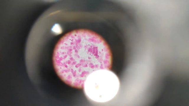 Human Skin Under microscope [ Quick video ] смотреть онлайн