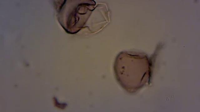 Unknown Fungal Spore Vid #1 смотреть онлайн