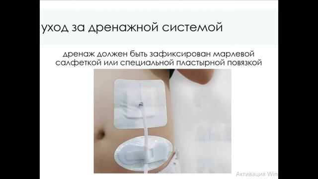 ДРЕНАЖИ. УХОД ЗА НИМИ. смотреть онлайн