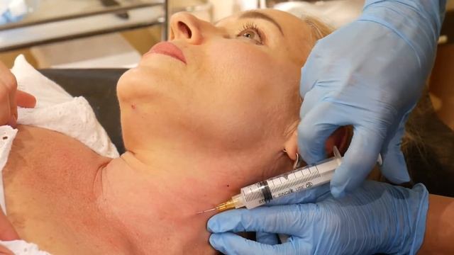 Trueself. Шея + декольте. Канюля. смотреть онлайн