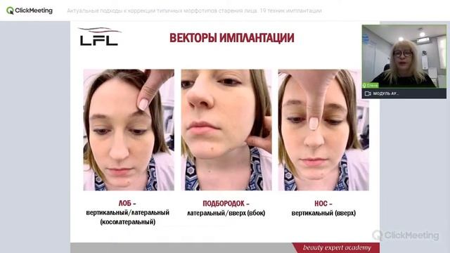 Вебинар: Актуальные подходы к коррекции типичных морфотипов старения лица. 19 техник имплантации. смотреть онлайн