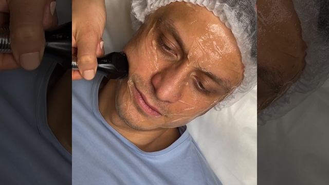 Inmode. Процедура «Forma» для лица. Мужчинам тоже нужен уход смотреть онлайн