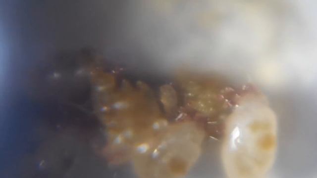 Клещи съевшие растение под микроскопом смотреть онлайн