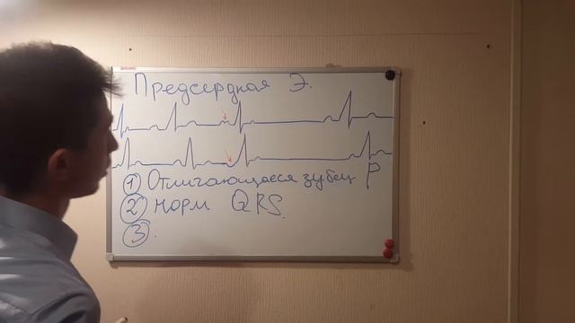ЭКСТРАСИСТОЛИЯ НА ЭКГ:ЖЕЛУДОЧКОВАЯ,АТРИОВЕНТРИКУЛЯРНОЕ,ПРЕДСЕРДНАЯ! смотреть онлайн