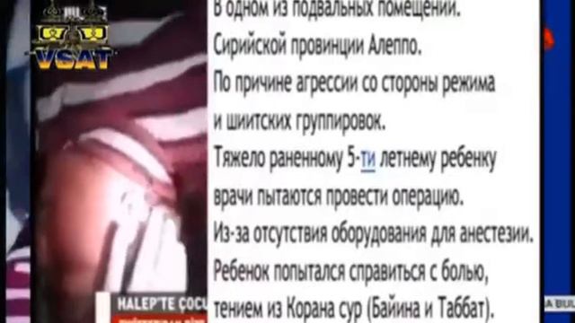 Дабы не чувствовать боль, ребёнок читает Коран смотреть онлайн
