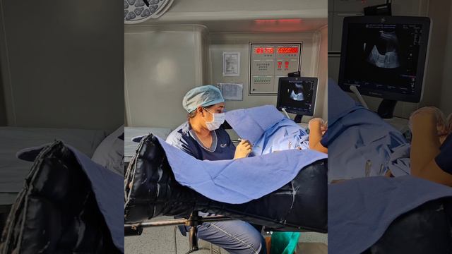 Embryo transfer | Dr Rana Choudhary | IVF #pregnancy #embryotransfer #dr.ranachoudhary #DrRana смотреть онлайн