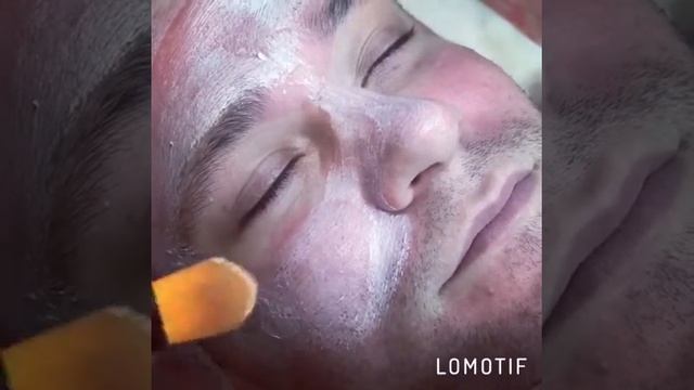 Мужская чистка лица смотреть онлайн