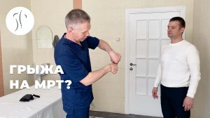 Сорвал спину. На мрт грыжа L5-S1. | Костоправ Саксин Алексей