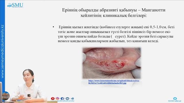 Ауыз кілегей қабығы мен еріндер жиегінің обыралды аурулары смотреть онлайн