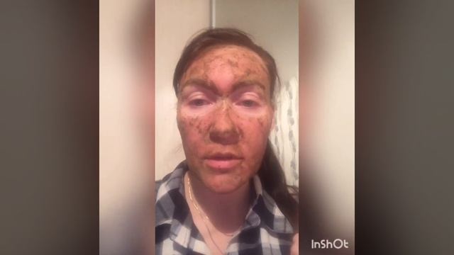 Пилинг для лица. Мощный пилинг лица. Пилинг бодягой. Пилинг в домашних условиях. смотреть онлайн