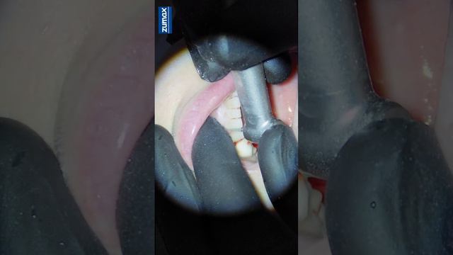 Вертипреп.mp4 смотреть онлайн