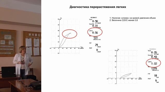 Влияние ИВЛ на организм. Часть 1 - ИВЛ и гемодинамика.