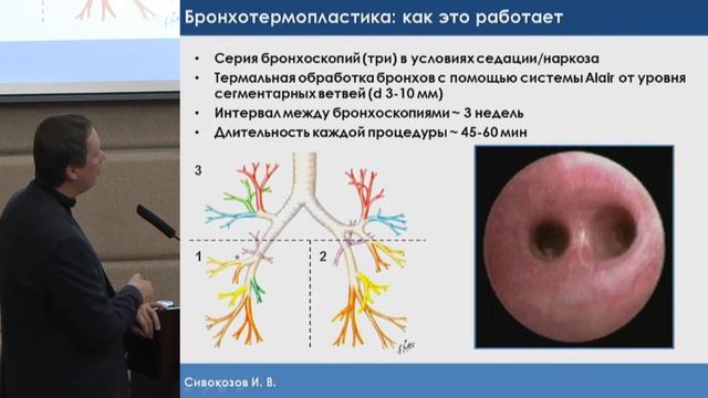 Сивокозов И.В., Бронхиальная астма - взглад бронхолога. смотреть онлайн