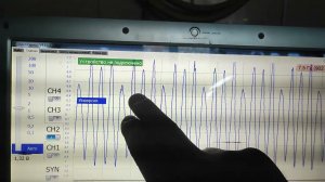 калина жалобы на детонацию. неисправный мотор после кап ремонта