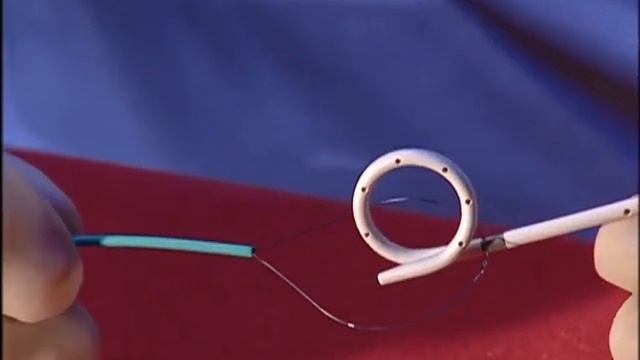 Удалитель стентов мочеточниковых смотреть онлайн