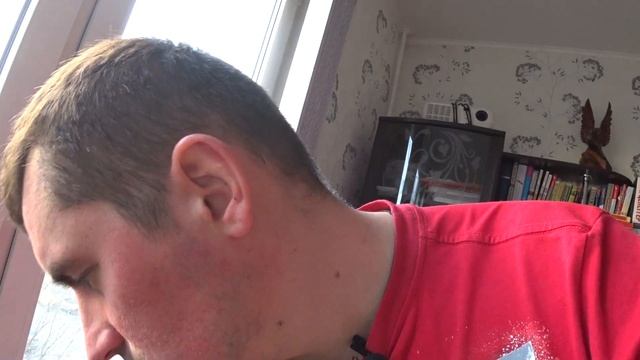 Демодекоз // Битва против Демодекоза // Демодекоз лечение // День 2 смотреть онлайн