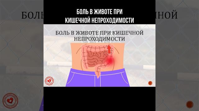 Боль в животе при кишечной непроходимости #кишечник #болитживот #больвживоте #живот смотреть онлайн