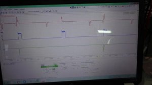 Mercedes Vito 638 не заводится ( жесть ) что может быть