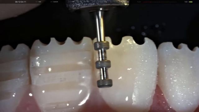 ORAL CLINIC - ВИНИРЫ смотреть онлайн