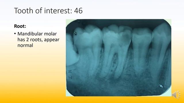 Radiographic interpretation made easy case 9 Solved examples смотреть онлайн
