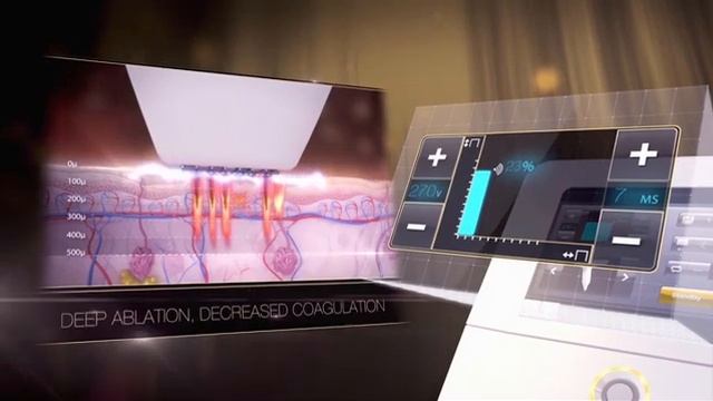 нанофракционное радиоволновое омоложение смотреть онлайн