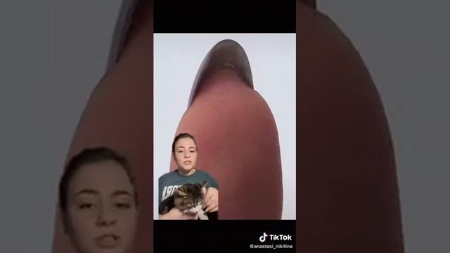 гипонихий это? смотреть онлайн