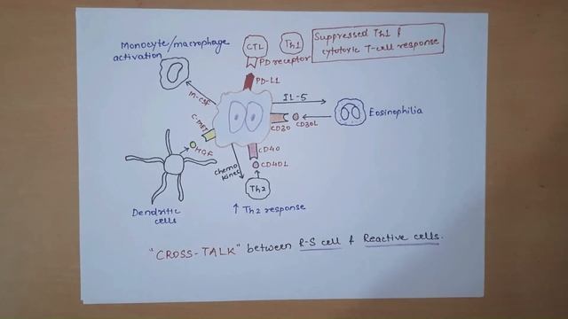 Hodgkin's Lymphoma | Hodgkin's disease || Pathology смотреть онлайн