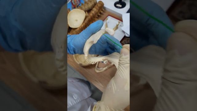 анатомия кости черепа человека смотреть онлайн