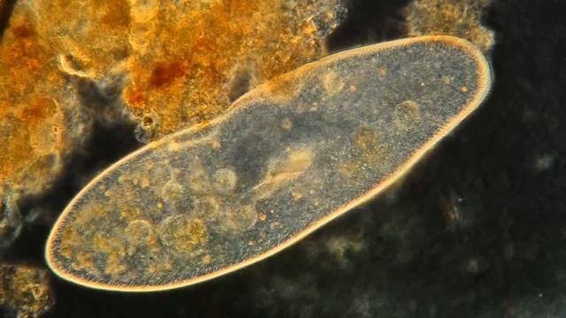 Paramecium Feeding Magnified 400X! High Definition! смотреть онлайн