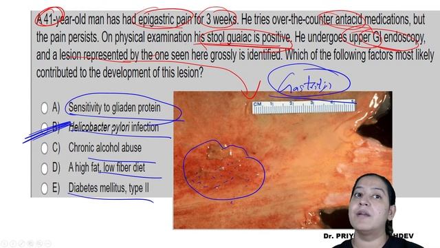 NEET PG - Image Based Questions | GIT Pathology | 2021 | Let's crack NEET PG | Dr. Priyanka смотреть онлайн