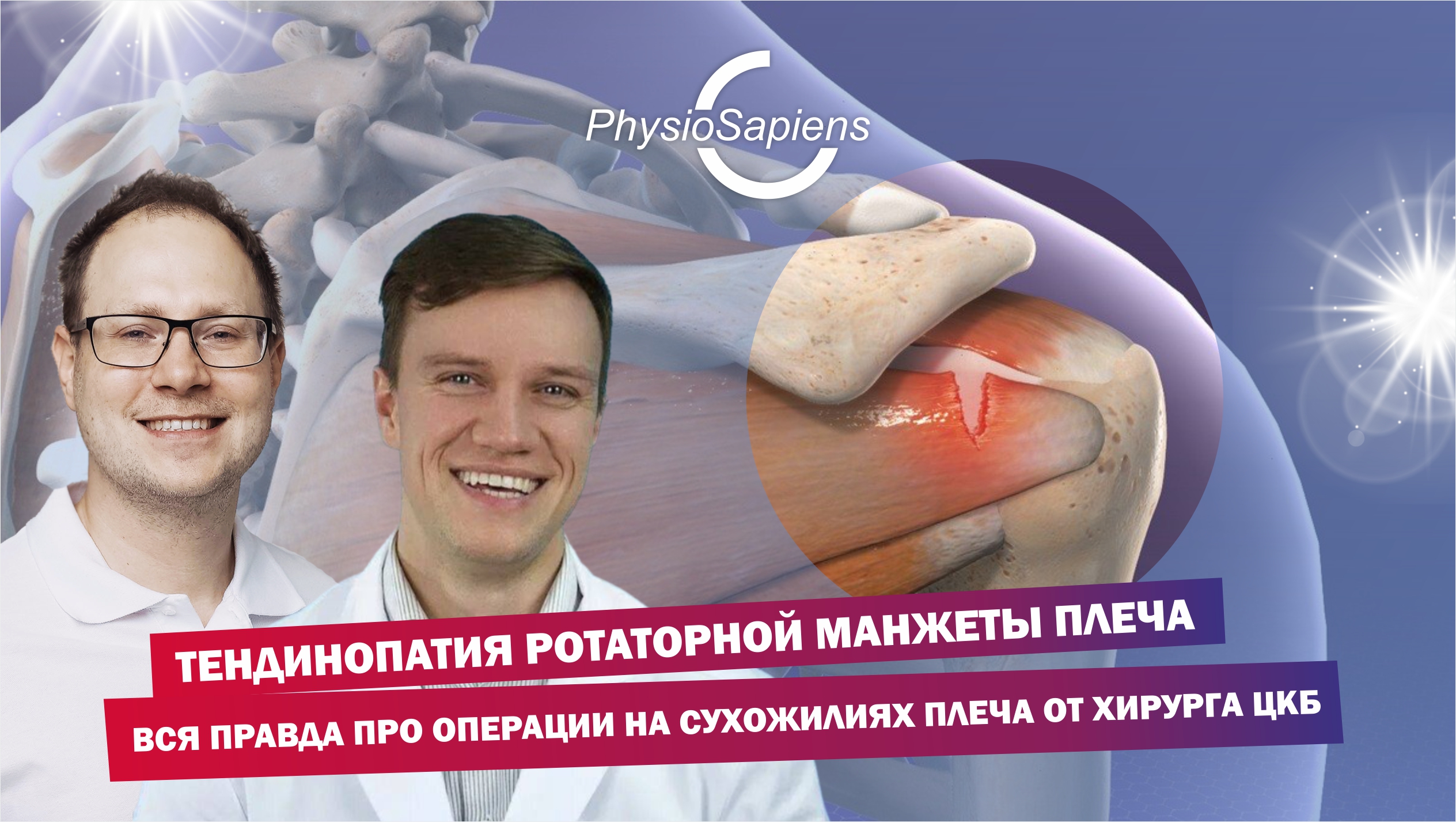 Тендинопатия ротаторной манжеты плеча - вся правда про операции на сухожилиях плеча от хирурга ЦКБ смотреть онлайн
