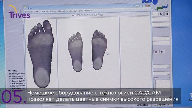 Индивидуальные стельки Trives смотреть онлайн