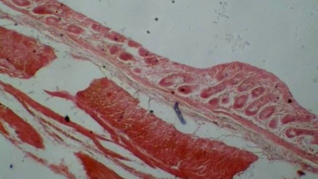 15 Recto Anal Junction GIT CD histo смотреть онлайн