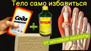 1 ч.л. НАТОЩАК! Подагра боится как Огня Обычной... Кристаллы Мочевой станут Водой !