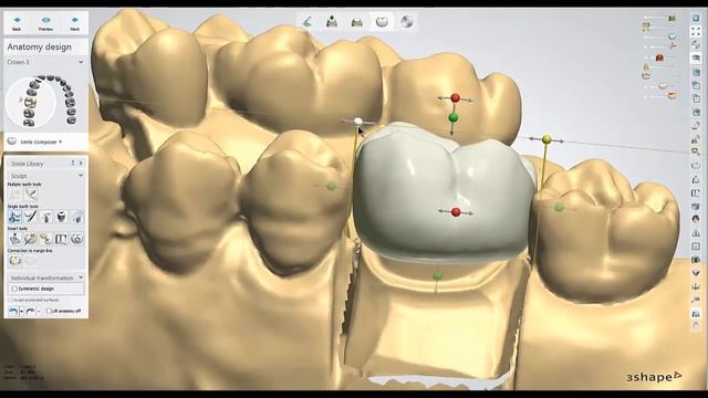 Dental Lab Life: Designing a Crown in 3Shape смотреть онлайн