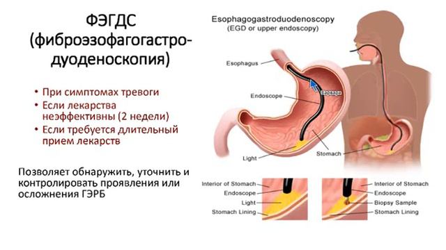 Изжога !!! Варвара Веретюк смотреть онлайн