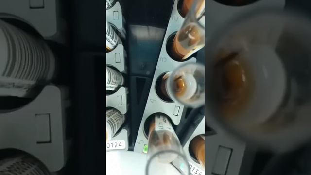 Анализ на генетику рака. #онкология #рак #здоровье #shortsvideo #рекомендации #топ #жизнь #днк смотреть онлайн