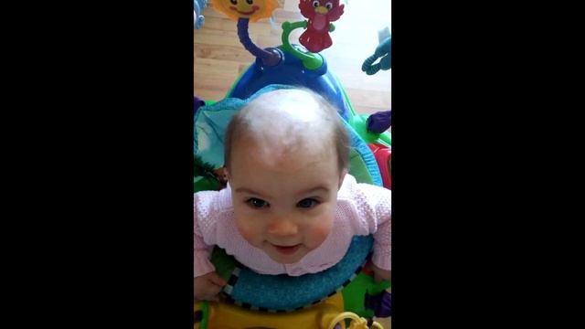 Присмотревшись к голове младенца, врачи побледнели. Такого они еще не видели! смотреть онлайн