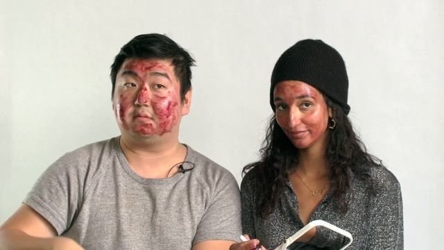 Team Tries: The Ordinary AHA 30% + BHA 2% Peeling Solution