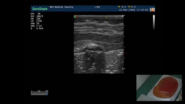 Ультразвуковая анатомия молочной железы практическое занятие на фантоме.mp4 смотреть онлайн