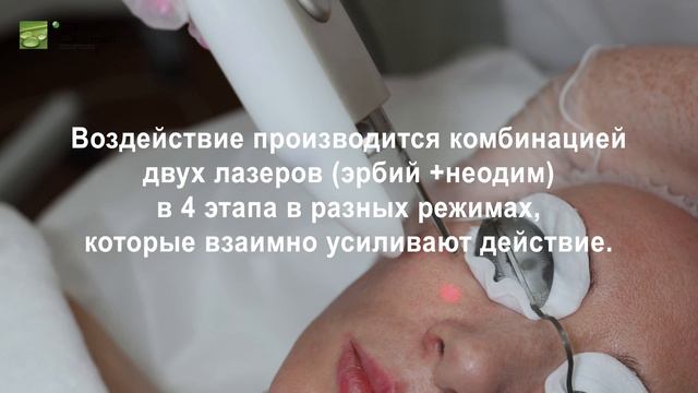 Лазерное омоложение Fotona 4D смотреть онлайн
